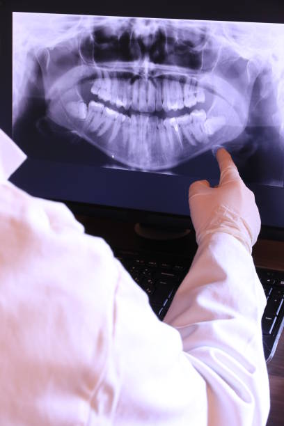 Best Emergency Wisdom Teeth Removal in North Wilkesboro, NC