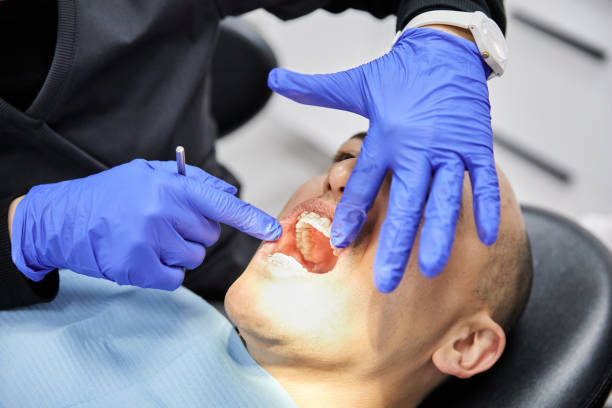 Best Weekend Emergency Dentist in North Wilkesboro, NC